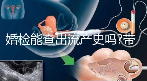 婚檢能查出流產(chǎn)史嗎?帶你詳細解答相關(guān)疑惑