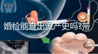 婚檢能查出流產(chǎn)史嗎?帶你詳細(xì)解答相關(guān)疑惑