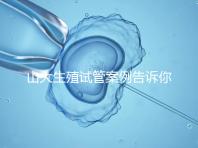 山大生殖試管案例告訴你，歷經3個月后懷孕辛酸史