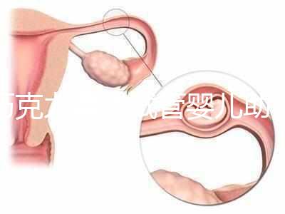 巧克力囊腫試管嬰兒助孕應(yīng)先治療？網(wǎng)友看法均有差異