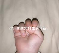 邳州哪家男科醫(yī)院好看，這家甲類機(jī)構(gòu)居然領(lǐng)先