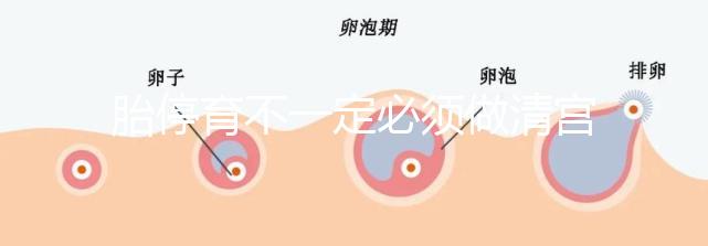 胎停育不一定必須做清宮！不滿足這3種情況,無需要刮宮