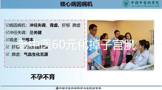 老中醫(yī)60元化掉子宮肌瘤偏方一覽，三棱效果怎樣用了就造