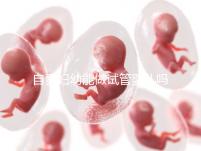 自貢婦幼能做試管嬰兒?jiǎn)幔克拇ㄊ?nèi)這些生殖中心才可以