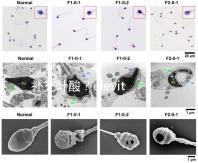 補(bǔ)充葉酸？elevit愛樂維那你不得不了解