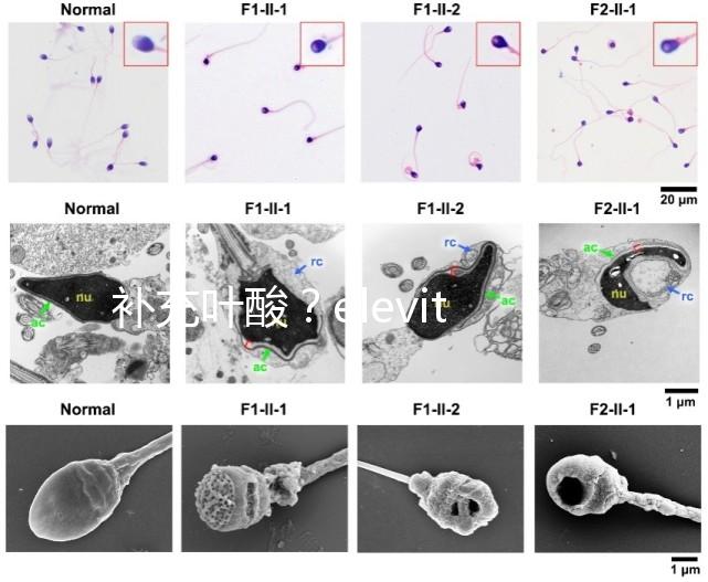 補(bǔ)充葉酸?elevit愛樂維那你不得不了解