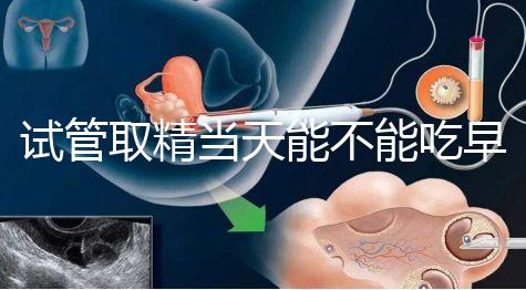 試管取精當天能不能吃早餐喝水的答案來咯咯，好不好一看就知道了？