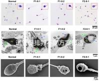 試管促排卵不同方案都適合哪些人？如何監測排卵？