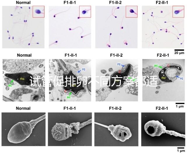 試管促排卵不同方案都適合哪些人？如何監測排卵？