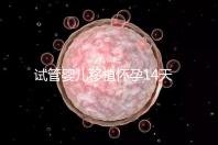 試管嬰兒移植懷孕14天，還能吃巧克力餅干嗎？