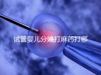 試管嬰兒分娩打麻藥打哪里看過來，疼不疼產(chǎn)科醫(yī)生告訴你