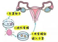 試管嬰兒二超后減藥原因已找到，對胎兒沒影響別瞎擔心