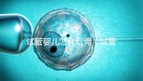 試管嬰兒怎樣取卵（試管嬰兒怎樣取卵視頻）