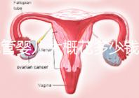試管嬰兒大概花多少錢（試管嬰兒大概花多少錢費(fèi)用）