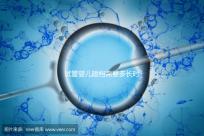 試管嬰兒建檔需要多長時間進來瞧，內含詳細流程供參考