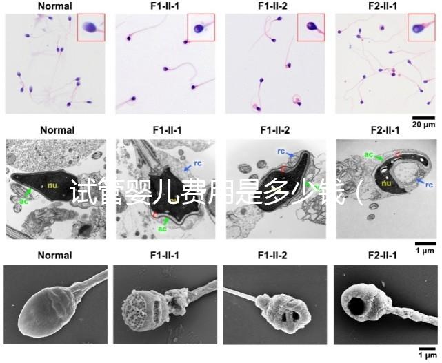 試管嬰兒費用是多少錢(試管嬰兒費用是多少錢一次)