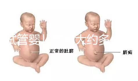 試管嬰兒費用大約多少2020年（試管嬰兒費用大約多少2020年上海）