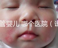 試管嬰兒 哪個醫(yī)院（試管嬰兒哪個醫(yī)院做的最好）