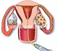 詳細說明去泰國杰特寧生殖中心做第三代試管技術的五大優勢，幫助你克服生育問題，快速隱藏！