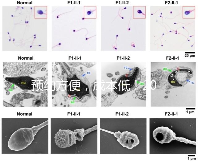 預約方便，成本低！2024年西安新城、臨潼、雁塔四維彩超指南