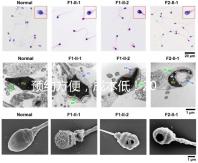 預約方便，成本低！2024年西安新城、臨潼、雁塔四維彩超指南