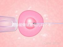 高齡能做試管嬰兒嗎？不是想做就能做得滿足這5個條件