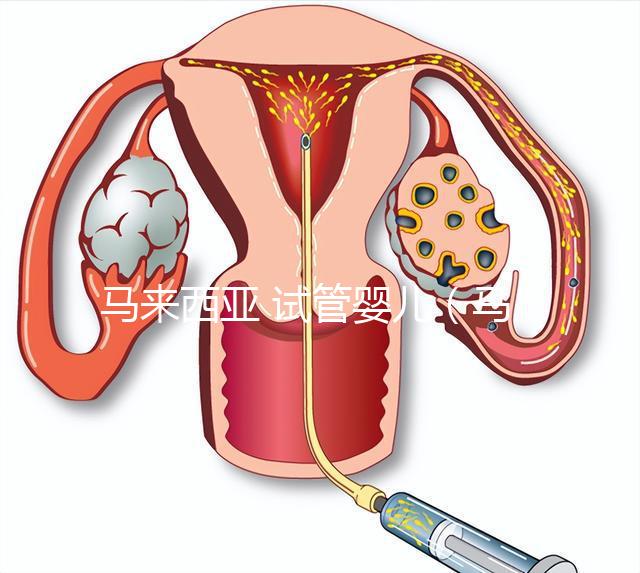 馬來西亞 試管嬰兒(馬來西亞試管嬰兒和泰國比較哪個(gè)更好)