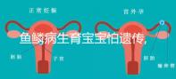 魚(yú)鱗病生育寶寶怕遺傳,第三代試管嬰兒基因篩查技術(shù)助好孕