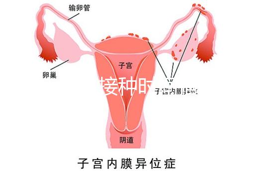 麻疹疫苗接種時(shí)間指南，初種年齡最好不要晚于這個(gè)月齡