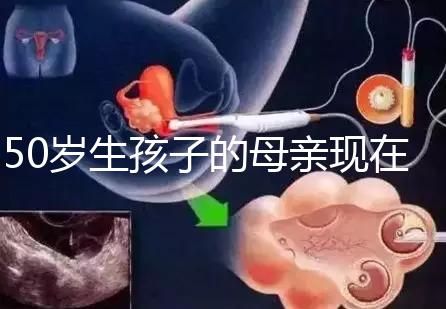 50歲生孩子的母親現在過得真不怎么樣，大齡不建議沖三胎