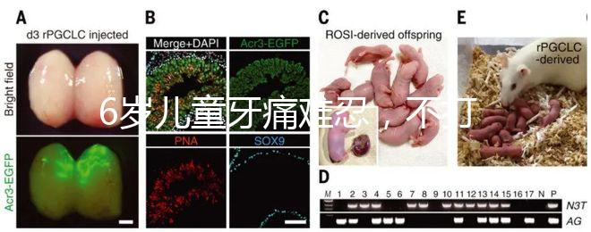 6歲兒童牙痛難忍，不打針吃藥5個小妙招快速止疼