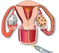 a2國產(chǎn)和進(jìn)口誰好不糾結(jié)，看配方、口感、價(jià)格對比再選
