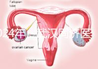 2024年，武漢同濟醫院不孕癥醫生排名公布，選擇專家迅速登記