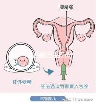 2024年西藏三胎新政策出臺，拉薩、日喀則產假戳多久？