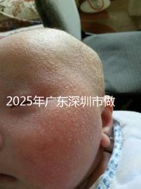 2025年廣東深圳市做第三代試管嬰兒費用，官方收費明細公開！