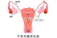 2025昆明三代試管助孕費(fèi)用一覽，8-15萬元，價格透明公開自主選擇
