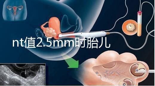 nt值2.5mm時胎兒異常幾率并不高，但羊水穿刺一定要做